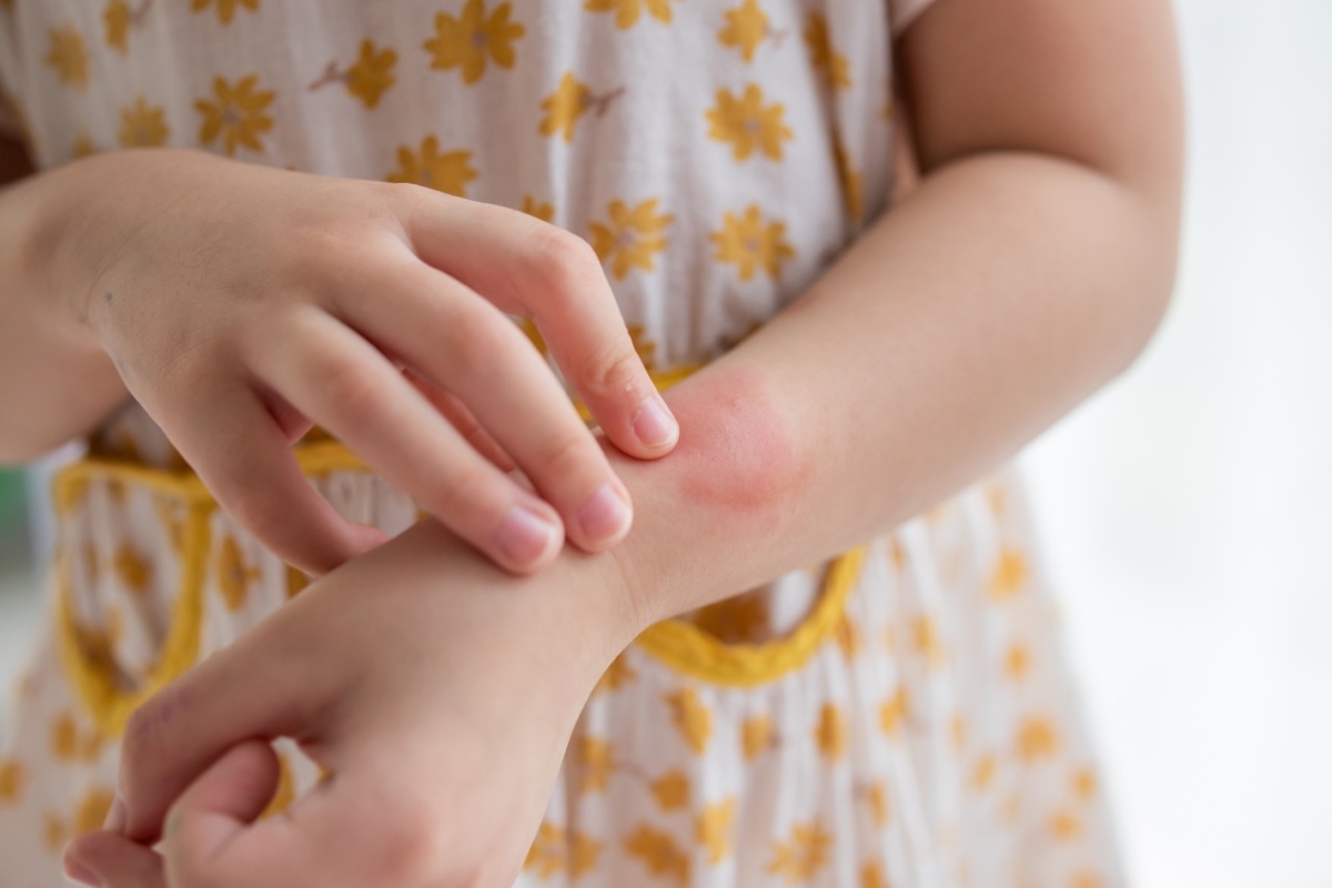 Biting behavior in children